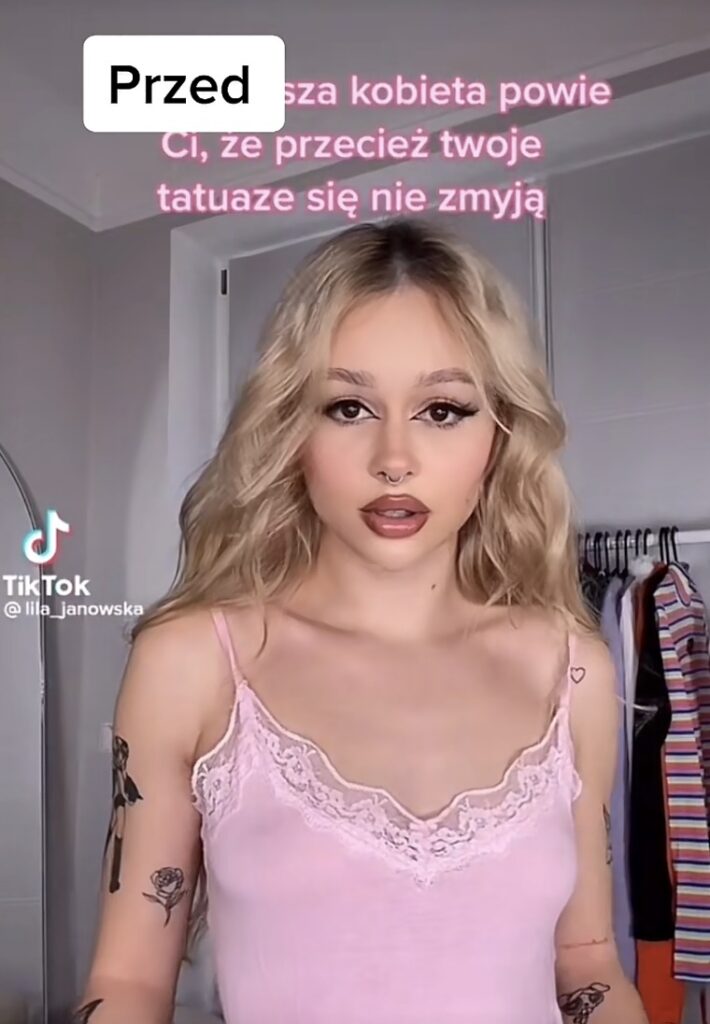 Lila Janowska przed operacją powiększenia piersi